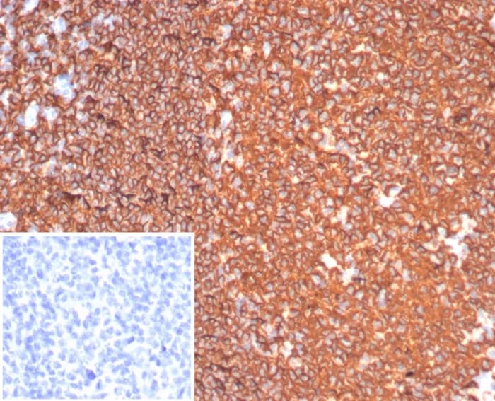 CD20 Antibody (MS4A1/6993R) - Azide and BSA Free Immunohistochemistry-Paraffin: CD20 Antibody (MS4A1/6993R) - Azide and BSA Free [NBP3-24154] -