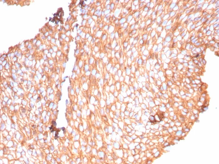 Uroplakin Ib Antibody (UPK1B/9258R) - Azide and BSA Free Immunohistochemistry-Paraffin: Uroplakin Ib Antibody (UPK1B/9258R) - Azide and BSA Free [NBP3-24164] -