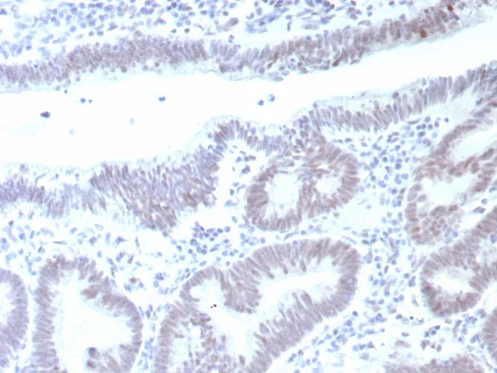 p53 Antibody (rTP53/8993) - Azide and BSA Free Immunohistochemistry-Paraffin: p53 Antibody (rTP53/8993) - Azide and BSA Free [NBP3-24175] -
