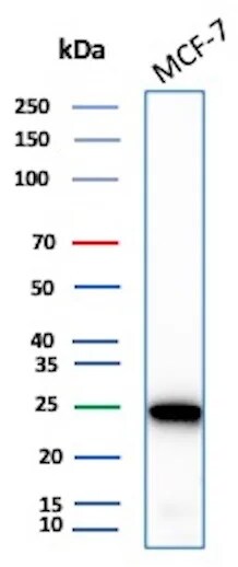Galectin-3 Antibody (rLGALS3/7286) - Azide and BSA Free Western Blot: Galectin-3 Antibody (rLGALS3/7286) - Azide and BSA Free [NBP3-24178] -