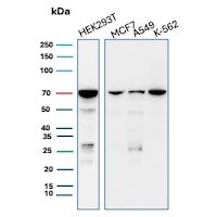 IMP3 Antibody (IMP3/8985R) - Azide and BSA Free Western Blot: IMP3 Antibody (IMP3/8985R) - Azide and BSA Free [NBP3-24183] -