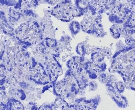 CD163L1 Antibody (CD163L1/7972) - Azide and BSA Free Immunohistochemistry-Paraffin: CD163L1 Antibody (CD163L1/7972) - Azide and BSA Free [NBP3-24185] -