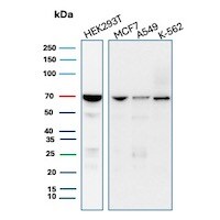 IMP3 Antibody (IMP3/8934R) - Azide and BSA Free Western Blot: IMP3 Antibody (IMP3/8934R) - Azide and BSA Free [NBP3-24192] -