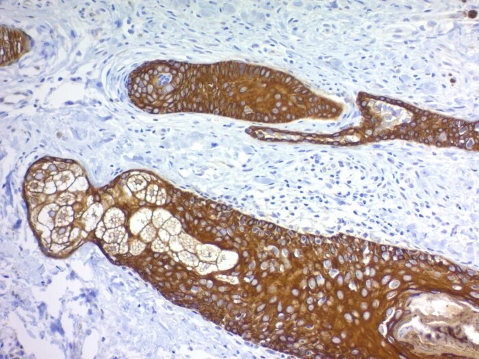 Cytokeratin, pan Antibody (MonoPoly/4999R) - Azide and BSA Free Immunohistochemistry-Paraffin: Cytokeratin, pan Antibody (MonoPoly/4999R) - Azide and BSA Free [NBP3-24196] -