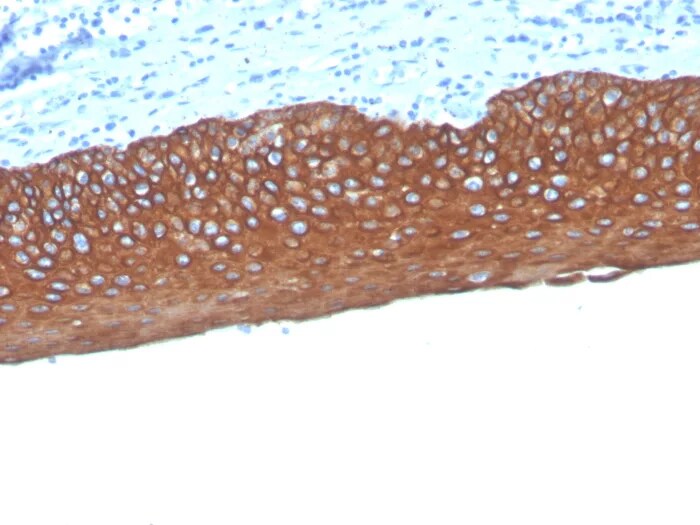Cytokeratin, pan Antibody (MonoPoly/4999R) - Azide and BSA Free Immunohistochemistry-Paraffin: Cytokeratin, pan Antibody (MonoPoly/4999R) - Azide and BSA Free [NBP3-24196] -