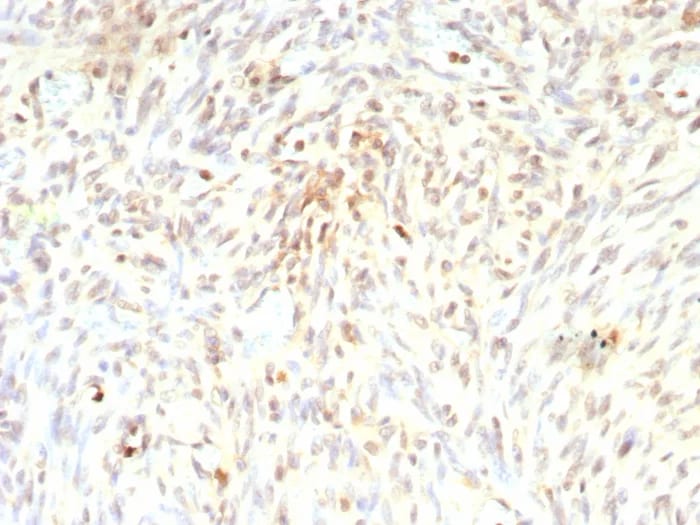 MDM2/HDM2 Antibody (rMDM2/9214) - Azide and BSA Free Immunohistochemistry-Paraffin: MDM2/HDM2 Antibody (rMDM2/9214) - Azide and BSA Free [NBP3-24198] -