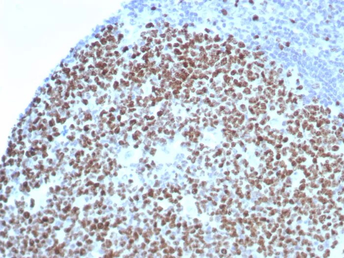 Ki67/MKI67 Antibody (rMKI67/8852) - Azide and BSA Free Immunohistochemistry-Paraffin: Ki67/MKI67 Antibody (rMKI67/8852) - Azide and BSA Free [NBP3-24199] -