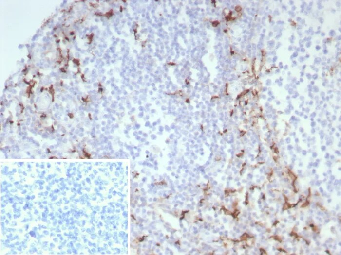 CD163 Antibody (M130/8822R) - Azide and BSA Free Immunohistochemistry-Paraffin: CD163 Antibody (M130/8822R) - Azide and BSA Free [NBP3-24218] -