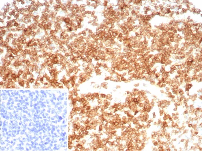 CD27/TNFRSF7 Antibody (LPFS2/8607R) - Azide and BSA Free Immunohistochemistry-Paraffin: CD27/TNFRSF7 Antibody (LPFS2/8607R) - Azide and BSA Free [NBP3-24224] -