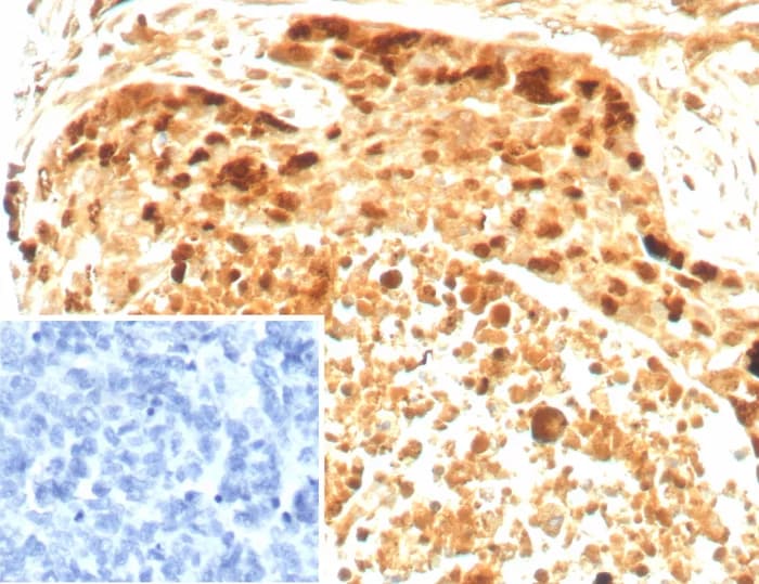 Survivin Antibody (BIRC5/8936R) - Azide and BSA Free Immunohistochemistry-Paraffin: Survivin Antibody (BIRC5/8936R) - Azide and BSA Free [NBP3-24238] -