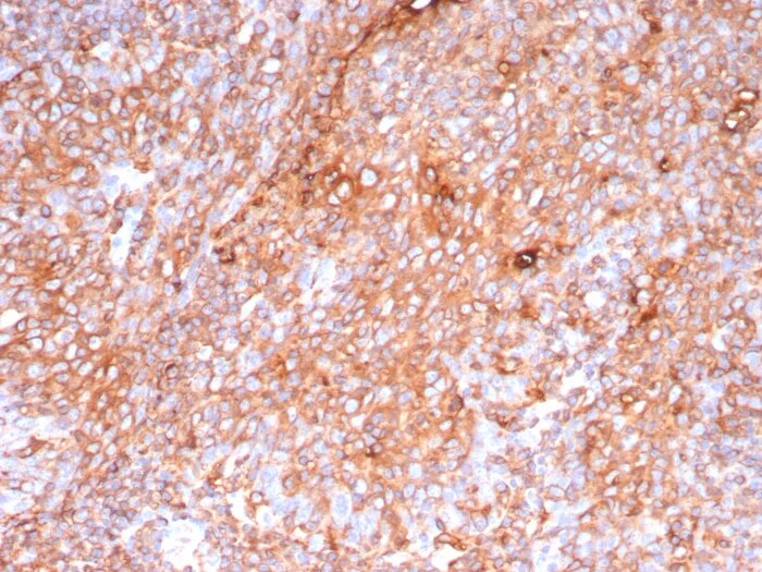 HLA DQ/DR/DP Antibody (HLA-Pan/9268R) - Azide and BSA Free Immunohistochemistry-Paraffin: HLA DQ/DR/DP Antibody (HLA-Pan/9268R) - Azide and BSA Free [NBP3-24248] -