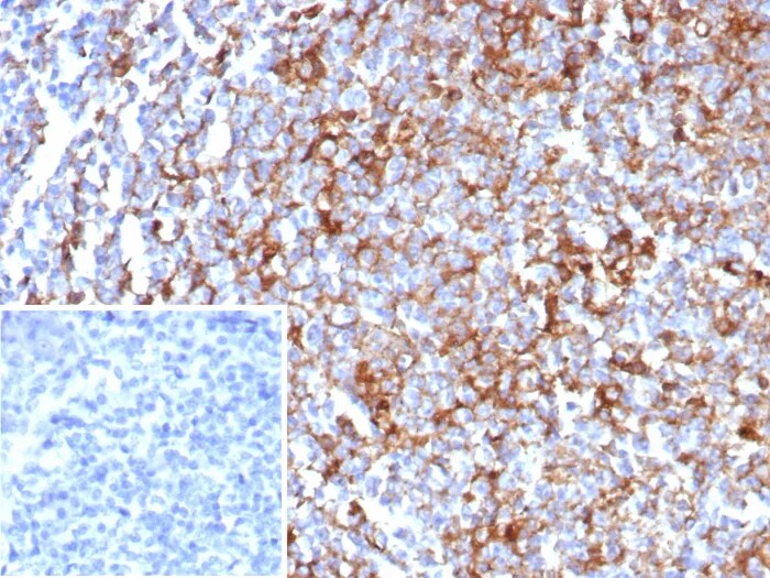 CD63 Antibody (rLAMP3/8604) - Azide and BSA Free Immunohistochemistry-Paraffin: CD63 Antibody (rLAMP3/8604) - Azide and BSA Free [NBP3-24267] -