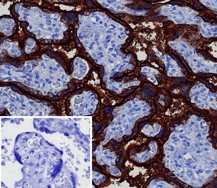 Alkaline Phosphatase/ALPP Antibody (ALPP/8112R) - Azide and BSA Free Immunohistochemistry-Paraffin: Alkaline Phosphatase/ALPP Antibody (ALPP/8112R) - Azide and BSA Free [NBP3-24271] -