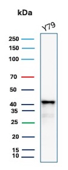 Glutamine Synthetase Antibody (rGLUL/8621) - Azide and BSA Free Western Blot: Glutamine Synthetase Antibody (rGLUL/8621) - Azide and BSA Free [NBP3-24286] -