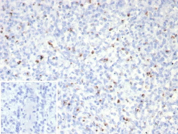 Perforin Antibody (rPRF1/8058) - Azide and BSA Free Immunohistochemistry-Paraffin: Perforin Antibody (rPRF1/8058) - Azide and BSA Free [NBP3-24297] -