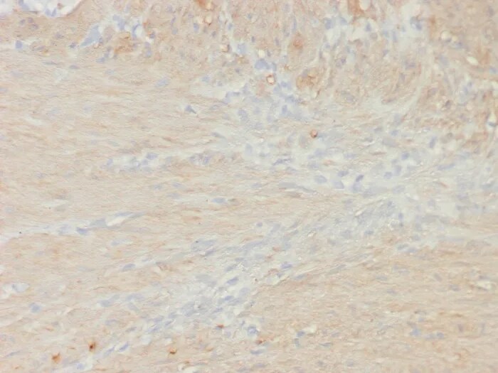 Myosin heavy chain 11 Antibody (rMYH11/8066) - Azide and BSA Free Immunohistochemistry-Paraffin: Myosin heavy chain 11 Antibody (rMYH11/8066) - Azide and BSA Free [NBP3-24303] -