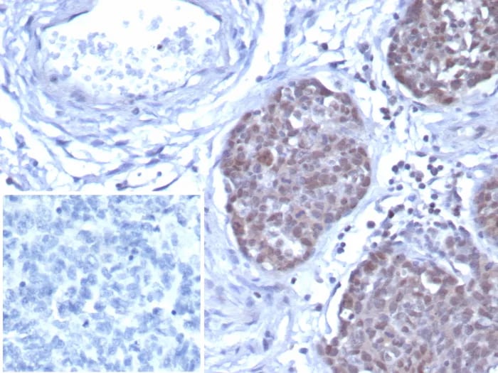 GATA-3 Antibody (GATA3/7686R) - Azide and BSA Free Immunohistochemistry-Paraffin: GATA-3 Antibody (GATA3/7686R) - Azide and BSA Free [NBP3-24311] -