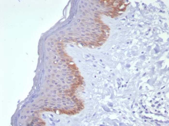 Cytokeratin 15 Antibody (KRT15/8312R) - Azide and BSA Free Immunohistochemistry-Paraffin: Cytokeratin 15 Antibody (KRT15/8312R) - Azide and BSA Free [NBP3-24320] -