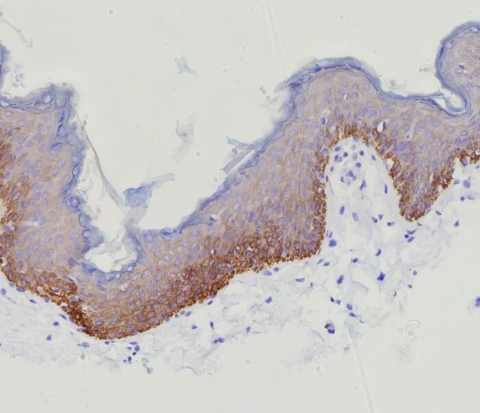 Cytokeratin 15 Antibody (KRT15/9088R) - Azide and BSA Free Immunohistochemistry-Paraffin: Cytokeratin 15 Antibody (KRT15/9088R) - Azide and BSA Free [NBP3-24326] -