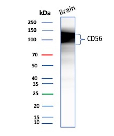 NCAM-1/CD56 Antibody (NCAM1/9074R) - Azide and BSA Free Western Blot: NCAM-1/CD56 Antibody (NCAM1/9074R) - Azide and BSA Free [NBP3-24334] -
