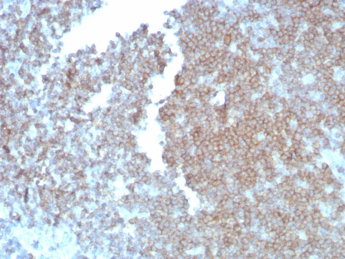CD27/TNFRSF7 Antibody (LPFS2/8838R) - Azide and BSA Free Immunohistochemistry-Paraffin: CD27/TNFRSF7 Antibody (LPFS2/8838R) - Azide and BSA Free [NBP3-24342] -