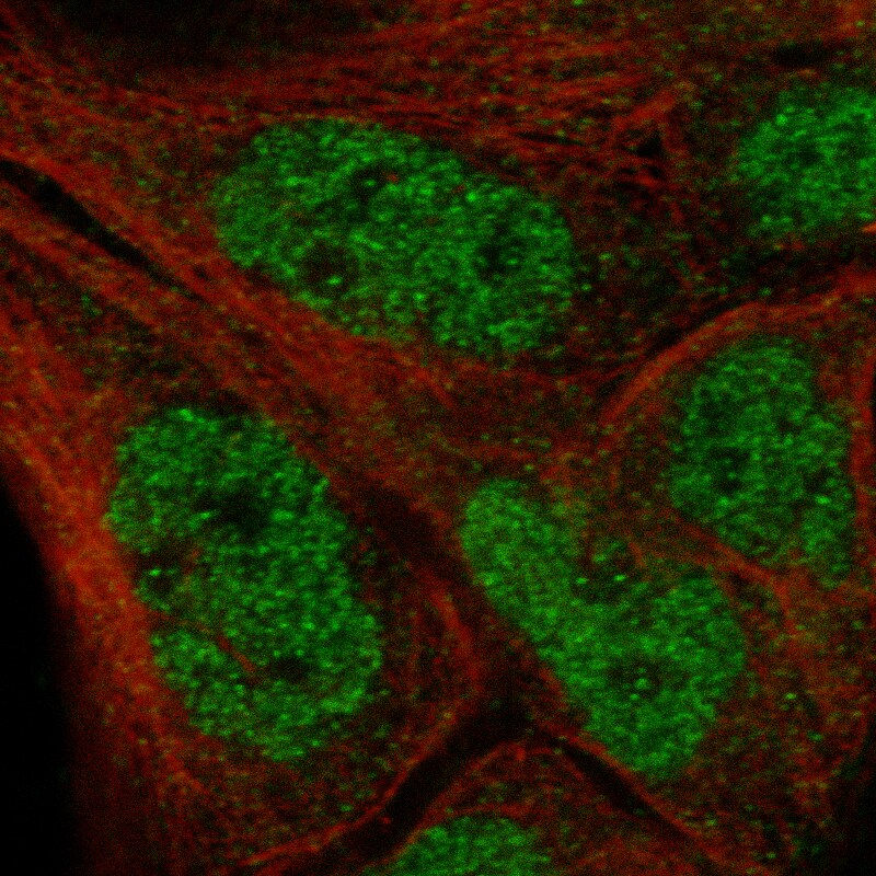 IL-33 Antibody (CL13438) - BSA Free Immunocytochemistry/ Immunofluorescence: IL-33 Antibody (CL13438) [NBP3-24558]