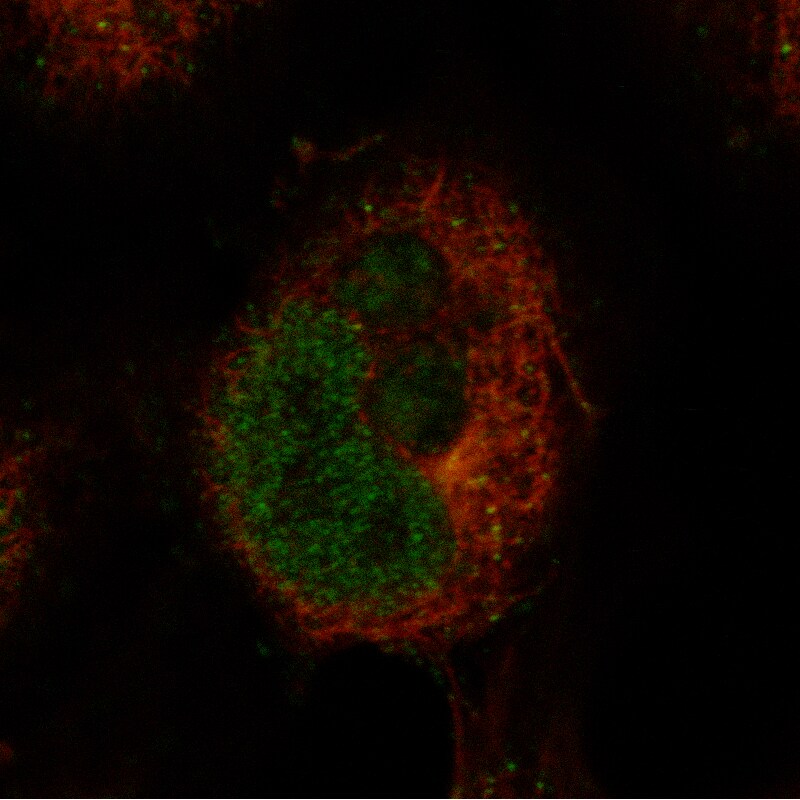 Ctip1 Antibody (CL13530) - BSA Free Immunocytochemistry/ Immunofluorescence: Ctip1 Antibody (CL13530) [NBP3-24563]