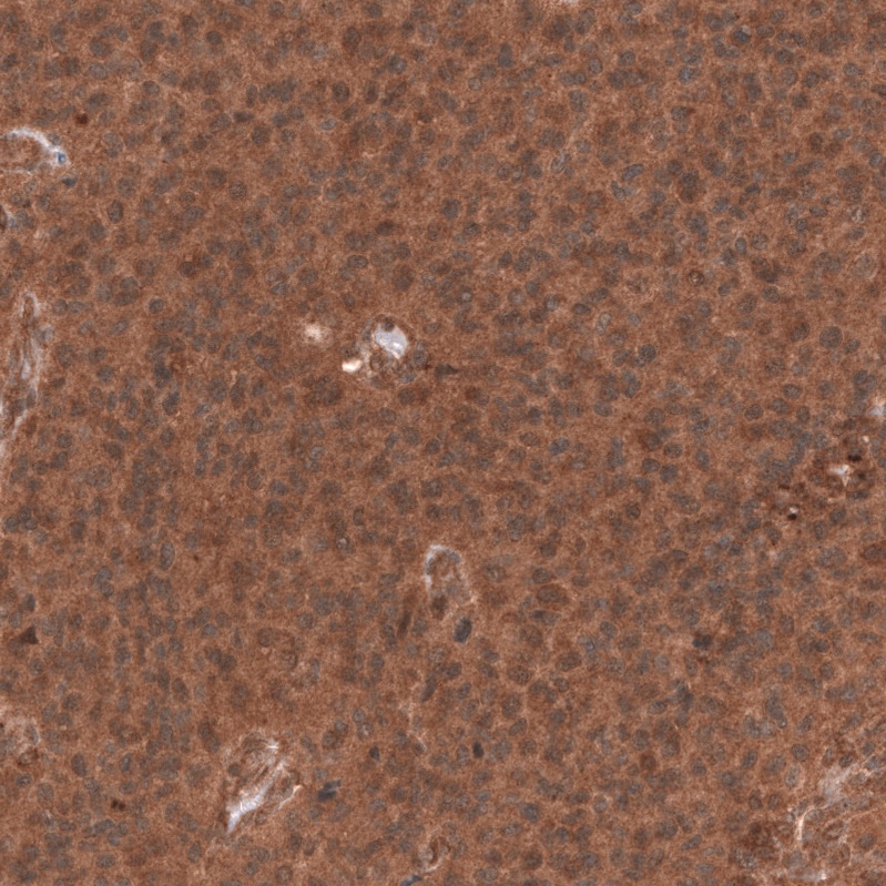 YAP1 Antibody (CL13628) - BSA Free Immunohistochemistry: YAP1 Antibody (CL13628) [NBP3-52440]