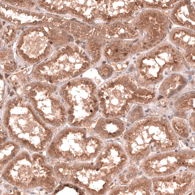YAP1 Antibody (CL13628) - BSA Free Immunohistochemistry: YAP1 Antibody (CL13628) [NBP3-52440]