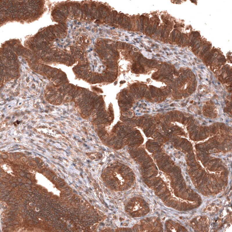 YAP1 Antibody (CL13628) - BSA Free Immunohistochemistry: YAP1 Antibody (CL13628) [NBP3-52440]