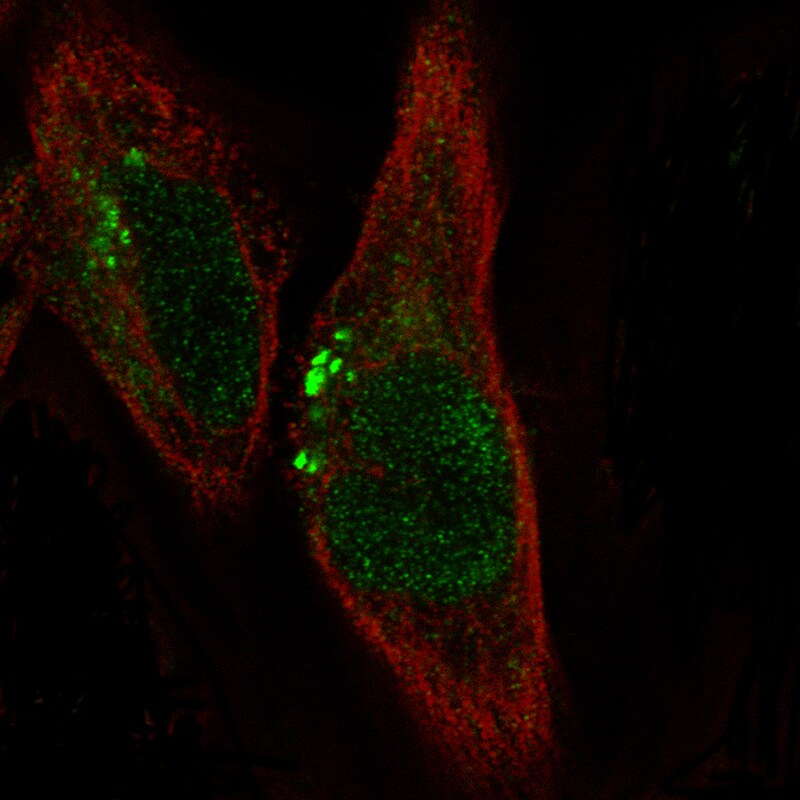 ADAM10 Antibody (CL13814) - BSA Free Immunocytochemistry/ Immunofluorescence: ADAM10 Antibody (CL13814) [NBP3-24579]