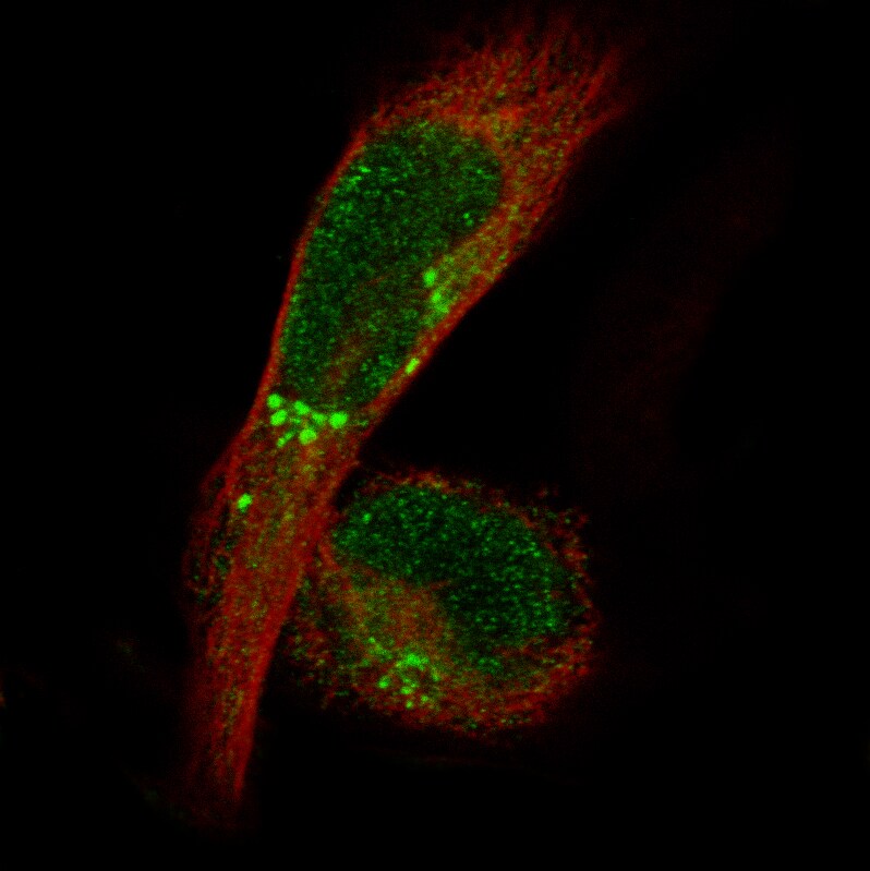 ADAM10 Antibody (CL13815) - BSA Free Immunocytochemistry/ Immunofluorescence: ADAM10 Antibody (CL13815) [NBP3-24580]
