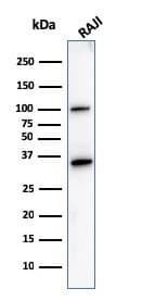CD20 Antibody (L26)