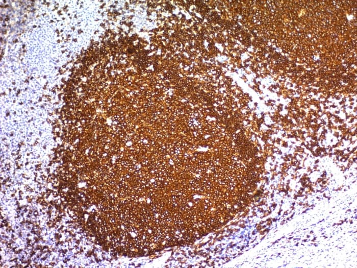 CD20 Antibody (L26)