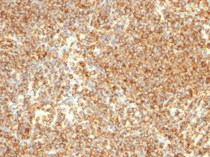CD20 Antibody (L26)