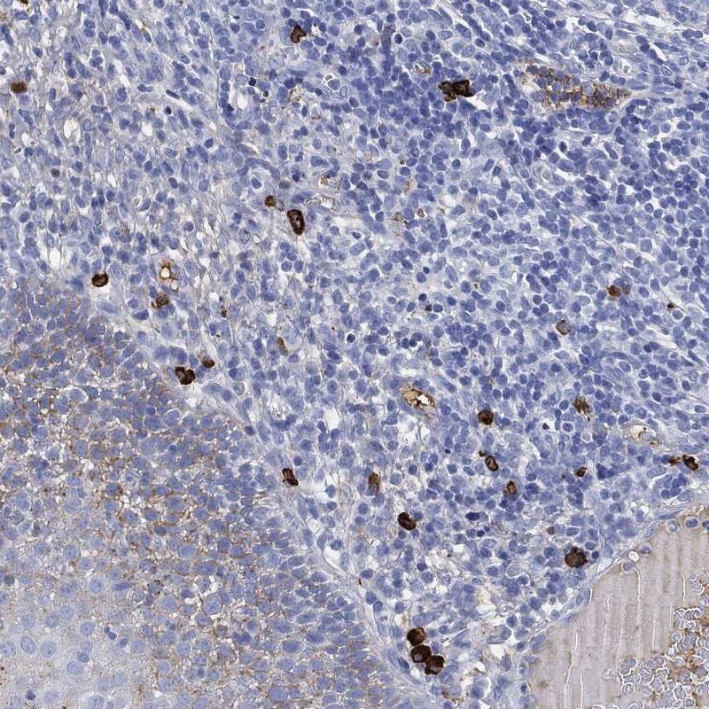 IGLV6-57 Antibody Immunohistochemistry-Paraffin: IGLV6-57 Antibody [NBP3-24694]