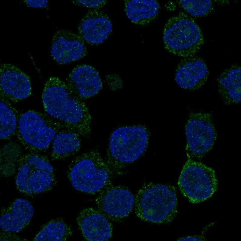 ANKRD30BL Antibody Immunocytochemistry/Immunofluorescence: ANKRD30BL Antibody [NBP3-24698]