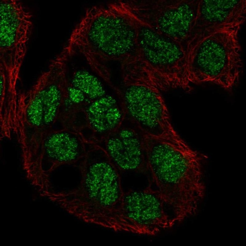 C2CD4A Antibody Immunocytochemistry/Immunofluorescence: C2CD4A Antibody [NBP3-24701]