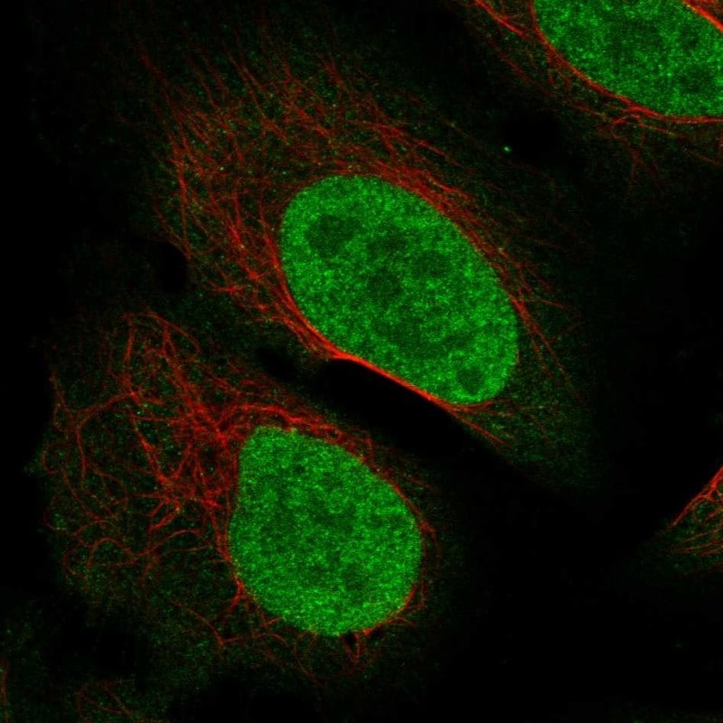 C2orf78 Antibody Immunocytochemistry/Immunofluorescence: C2orf78 Antibody [NBP3-24702]