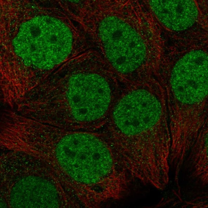 CBX6 Antibody Immunocytochemistry/Immunofluorescence: CBX6 Antibody [NBP3-24707]