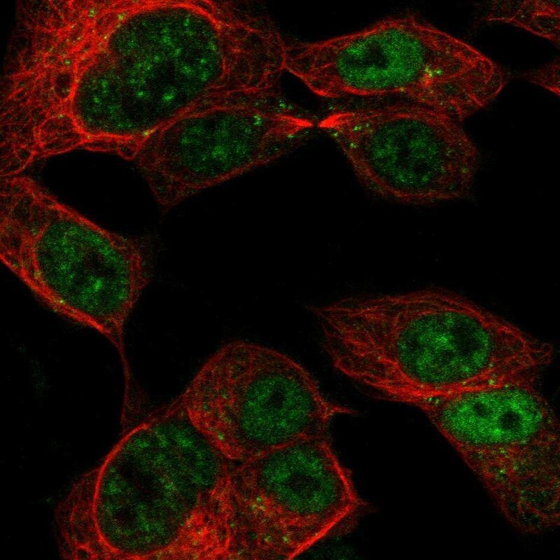 CCDC169 Antibody Immunocytochemistry/Immunofluorescence: CCDC169 Antibody [NBP3-24711]