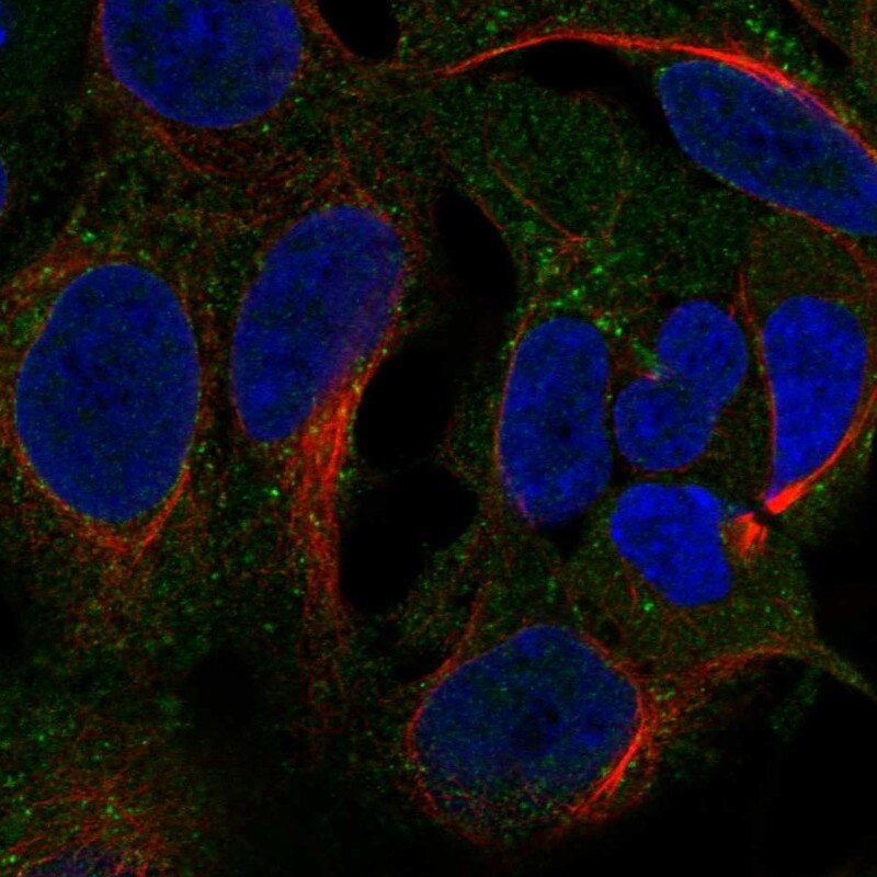 CCDC22 Antibody Immunocytochemistry/Immunofluorescence: CCDC22 Antibody [NBP3-24713]