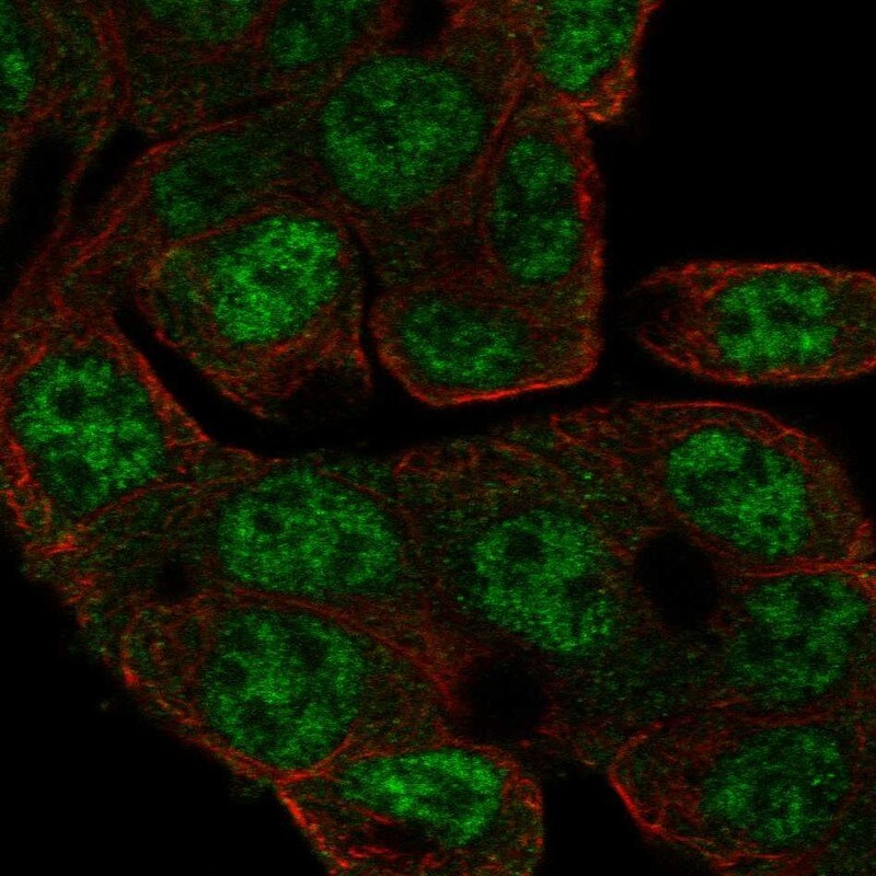 CCDC83 Antibody Immunocytochemistry/Immunofluorescence: CCDC83 Antibody [NBP3-24715]