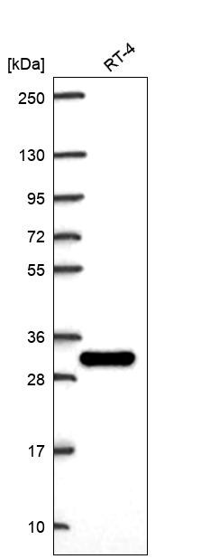 Galectin-3 Antibody Western Blot: Galectin-3 Antibody [NBP3-24716]