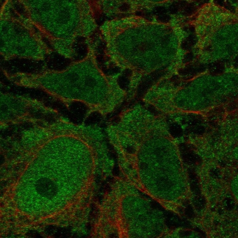 CCK-AR Antibody Immunocytochemistry/Immunofluorescence: CCK-AR Antibody [NBP3-24718]