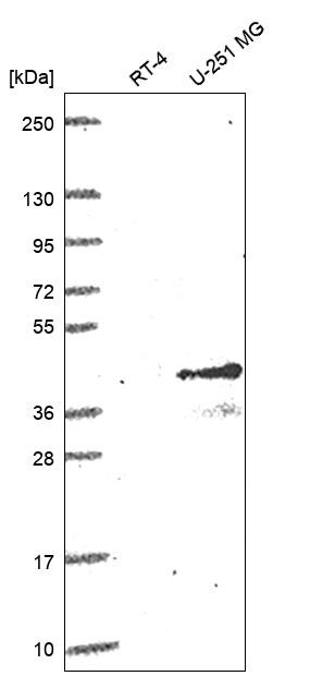 CD1c/BDCA-1 Antibody Western Blot: CD1c/BDCA-1 Antibody [NBP3-24722]