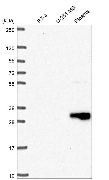 CD27/TNFRSF7 Antibody Western Blot: CD27/TNFRSF7 Antibody [NBP3-24724]