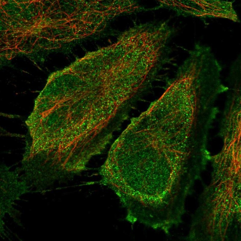 CD83 Antibody Immunocytochemistry/Immunofluorescence: CD83 Antibody [NBP3-24726]