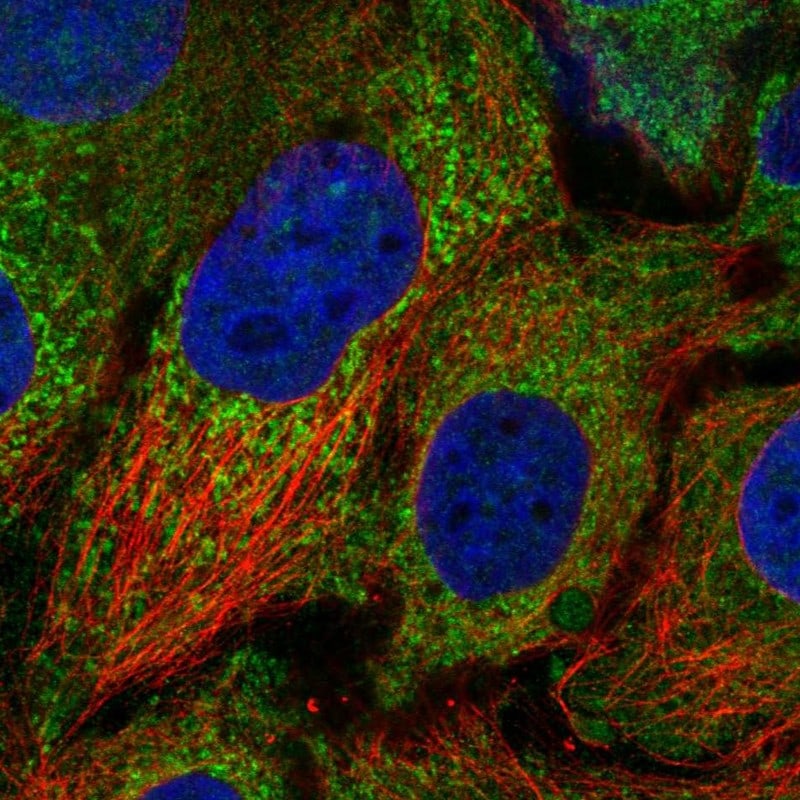 CDK5RAP1 Antibody Immunocytochemistry/Immunofluorescence: CDK5RAP1 Antibody [NBP3-24729]