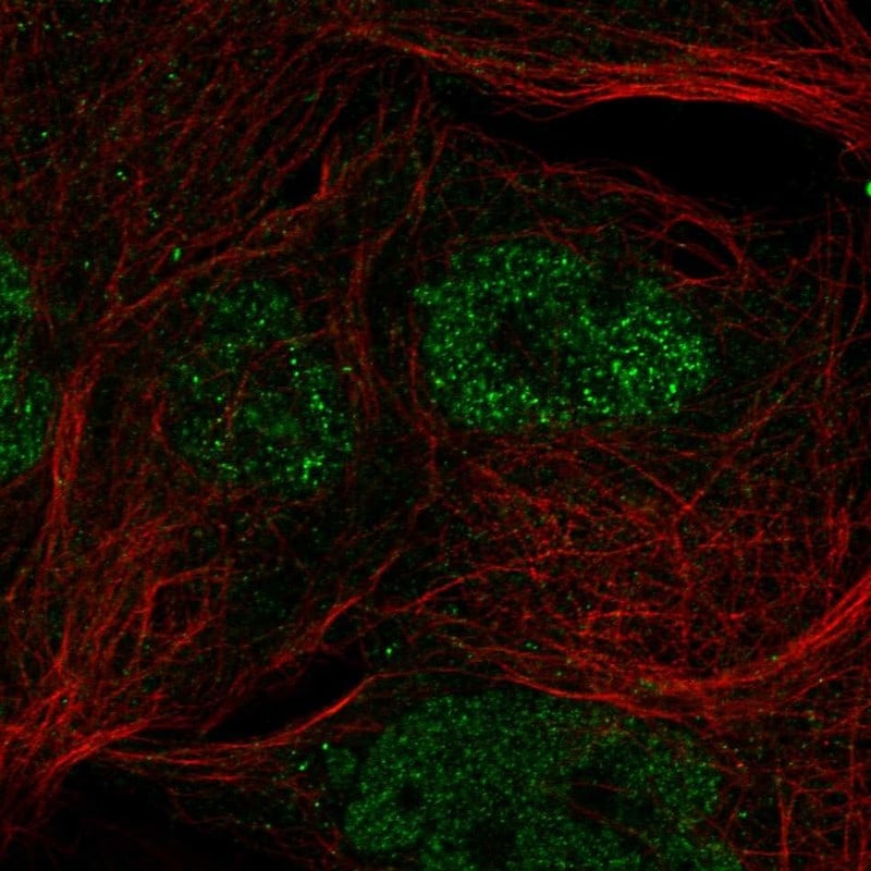 cGAS Antibody Immunocytochemistry/Immunofluorescence: cGAS Antibody [NBP3-24738]